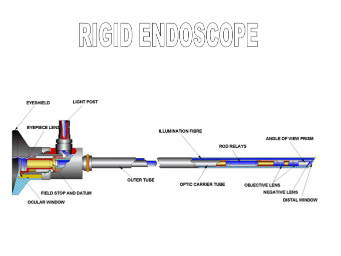 Rigid Endoscope VS Flexible Endoscope